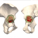 Pediatric Orthopaedics