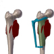 tumour Reconstruction